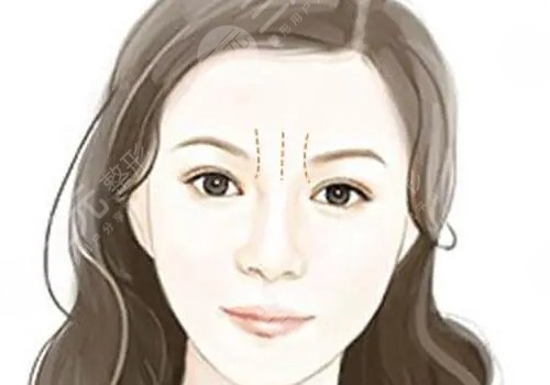 骨相抗衰原理是什么?