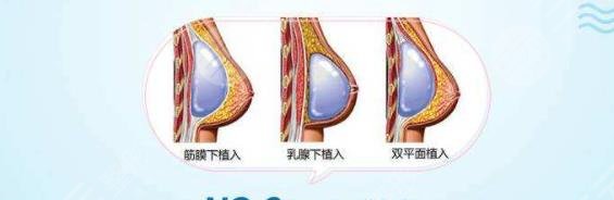 乳房