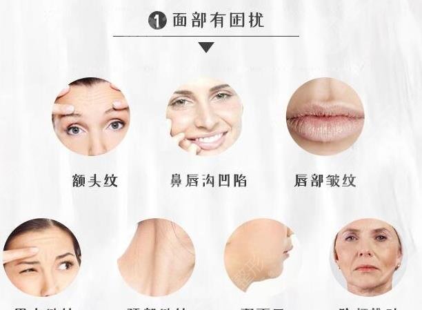 热玛吉