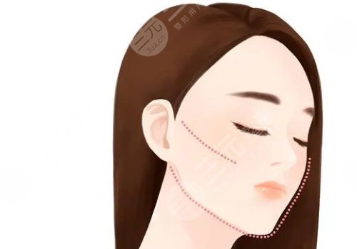 轮廓固定和筋膜提升哪个好