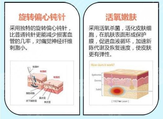 杭州腰腹部吸脂价格公布!好评医院2家分享,避坑指南~
