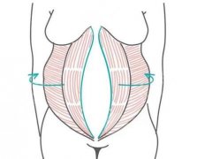 肚皮松弛下垂整形费用是多少？皮肤松弛的四个原因解析、日常要注意