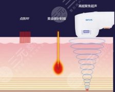 超声炮的作用原理是什么?超声炮美容误区和成本了解一下~ 超声炮的作用原理是什么?超声炮美容误区和成本了解一下~