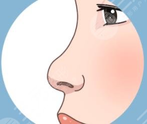 南方医院罗勇隆鼻怎么样