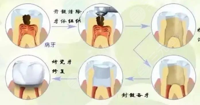 补牙封药后疼正?常吗?