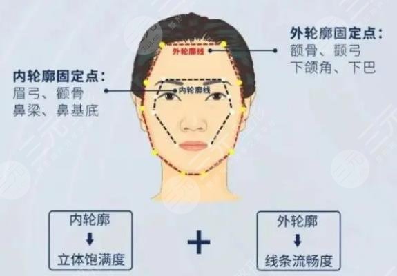 外轮廓填充用什么好?热门材料介绍!优点及价格分享~