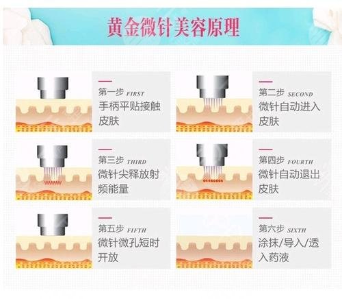 如何祛除脸上的疤痕?