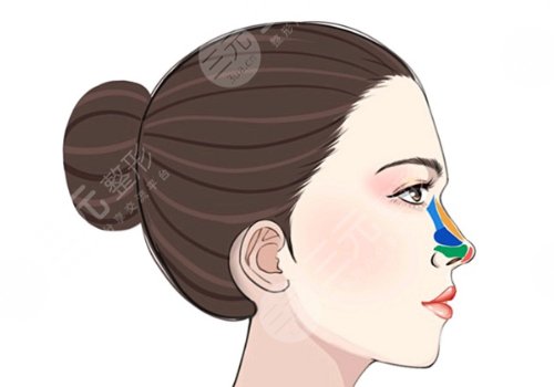 童列健做的鼻子好吗？
