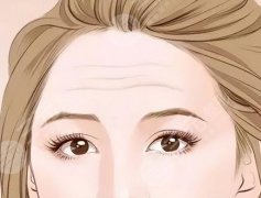 做小拉皮手术能够维持几年?不同类型维持时间不同、术后注意事项一览 做小拉皮手术能够维持几年?不同类型维持时间不同、术后注意事项一览