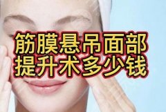筋膜悬吊面部提升术价格多少?价格相对适合很多人~手术简介 筋膜悬吊面部提升术价格多少?价格相对适合很多人~手术简介