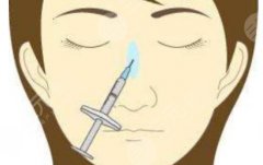 濡白天使1支够打鼻子吗?濡白天使和其他玻尿酸的区别介绍! 濡白天使1支够打鼻子吗?濡白天使和其他玻尿酸的区别介绍!