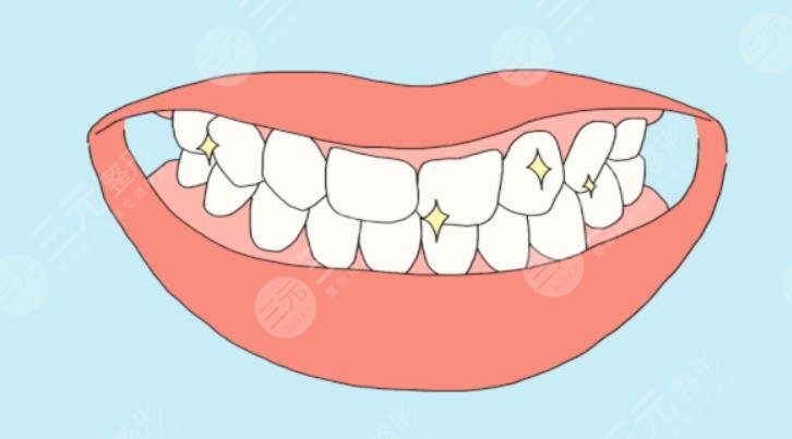 牙周炎的症状有哪些?