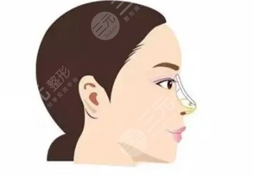 叶丽萍做鼻子怎么样？