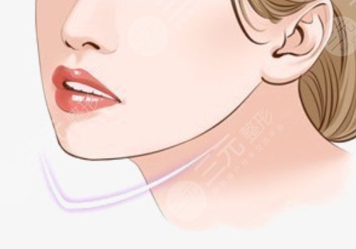 小v脸是怎样整出来的？