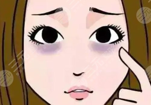 去黑眼圈的医美项目多少钱?有哪些?