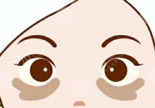 去黑眼圈的医美项目多少钱?有哪些?