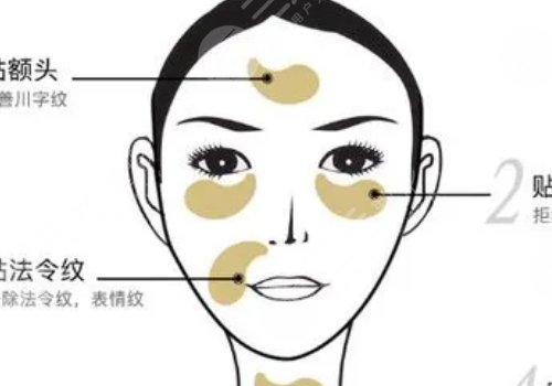 眼膜的正确使用方法
