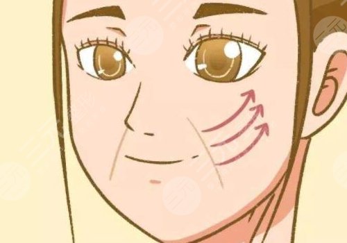 法令纹太深了有什么解决办法？