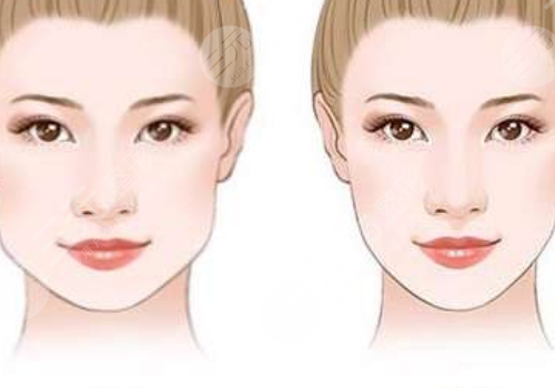 咬肌大怎么瘦下来