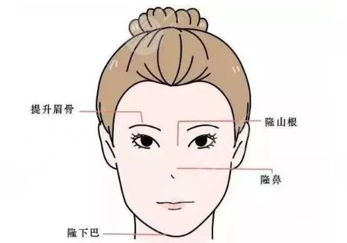 眉弓骨填充前后照片(案例)