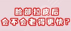 做拉皮会老的更快吗?拉皮手术有助于保持皮肤年轻状态~一起了解 做拉皮会老的更快吗?拉皮手术有助于保持皮肤年轻状态~一起了解