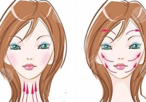 v脸绷带提升有效果吗？