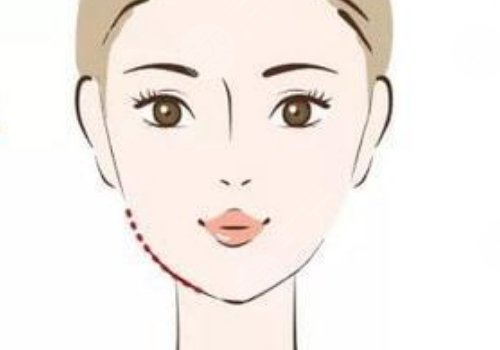 小v脸提升怎么做多少钱？