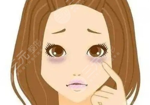 去黑眼圈和眼袋有效的方法是什么?眼周抗衰指南!