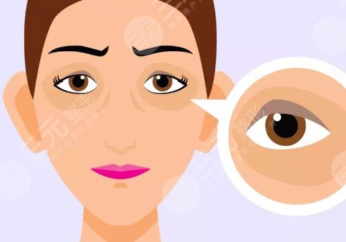 去黑眼圈和眼袋有效的方法是什么？眼周抗衰指南！