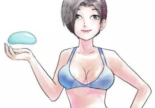 成都张雪峰医生做胸怎么样?