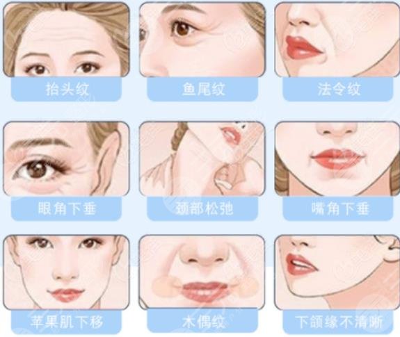 双矢量提升术多大岁数能做