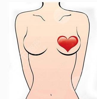 陈万芳脂肪丰胸案例