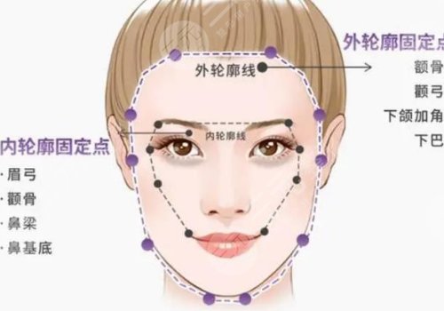 轮廓固定是什么意思