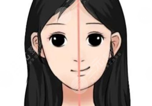 大小脸矫正手术有风险吗？