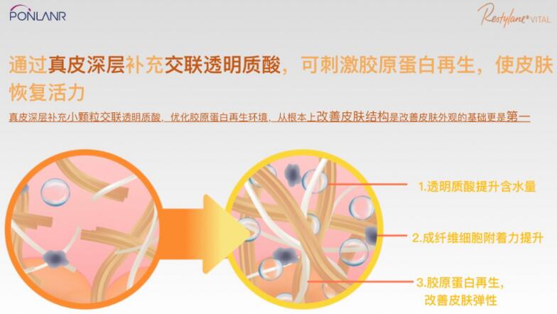 贵妇水光效果怎么样?高奢维养,美肤指南!