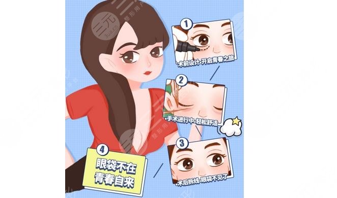 广州健丽医美(广州健丽医疗美容医院)去眼袋手术案例