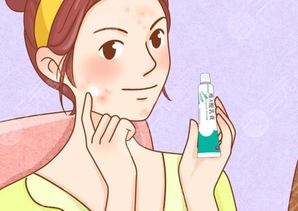 脸颊两侧长痘痘什么原因