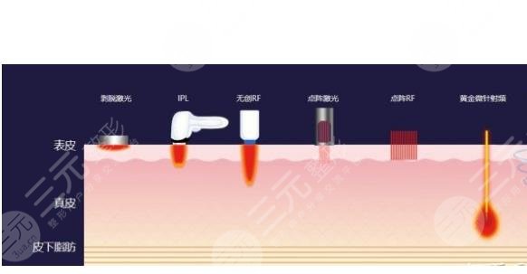 去黑眼圈和眼袋有效的方法是什么?眼周抗衰指南!