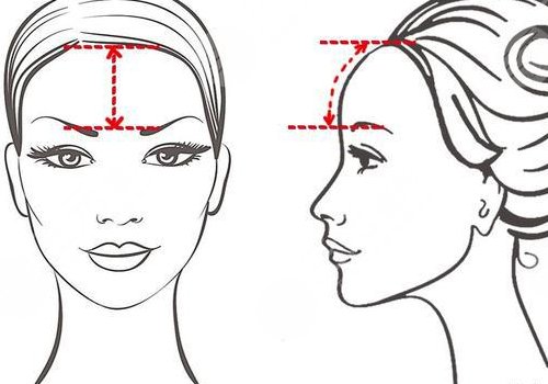 中庭太长怎么改良？