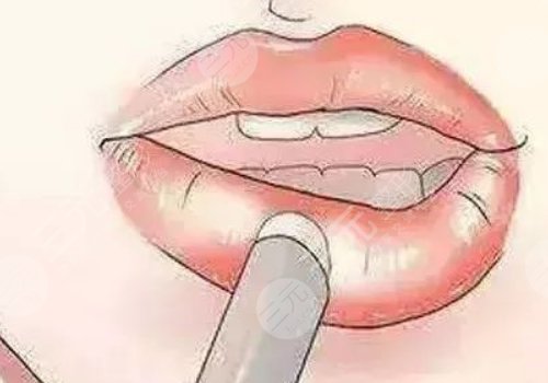 唇部老化的原因有哪些？唇部老化如何改良？