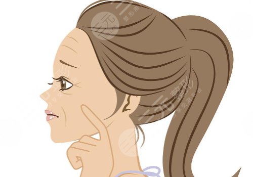 动态纹和静态纹哪个属于真性皱纹?