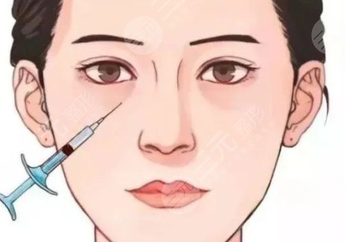 双美胶原蛋白填充泪沟能维持多久?