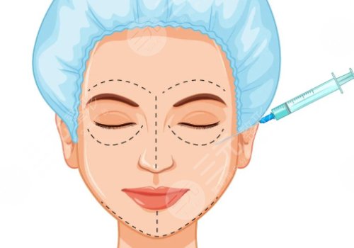 双美胶原蛋白填充泪沟能维持多久?