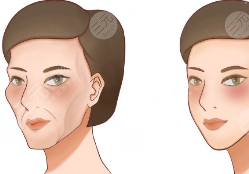 面中凹陷是什么原因