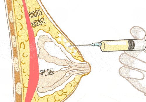 广州市荔湾区人民医院整形美容科怎么样？