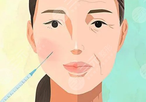薇旖美可以注射眼部周围的皱纹不？