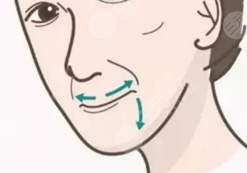 唇部老化的表现是什么?