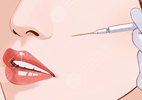 薇旖美可以注射眼部周围的皱纹不？