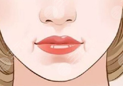 唇部老化的表现有哪些？改良方法有这些！