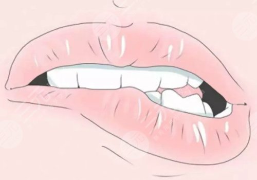 唇部老化的表现有哪些?改良方法有这些!